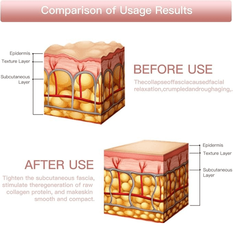 Destàre Skincare™ Mini HiFu EMS Device