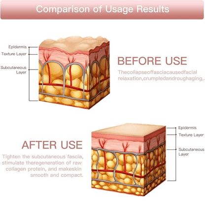 Destàre Skincare™ Mini HiFu EMS Device
