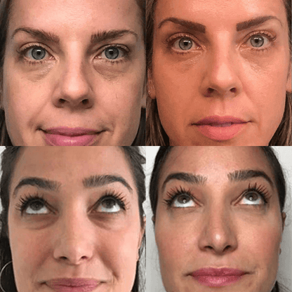 Destàre Skincare™ Volufiline Concentrate Serum