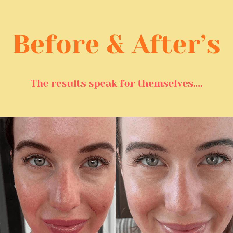 Destàre Skincare™ Volufiline Concentrate Serum