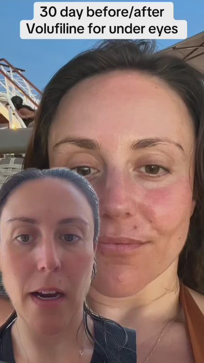 Destàre Skincare™ Volufiline Concentrate Serum